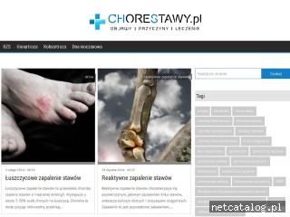 Zrzut ekranu strony www.chorestawy.pl